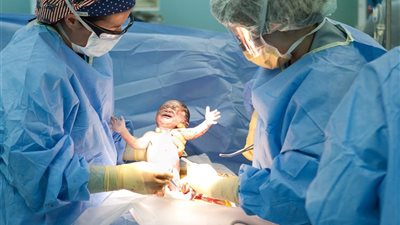 جلطات بالدم وتدمير للرحم.. الولادة القيصرية.. بيزنس الأطباء لتحقيق الثراء على حساب أرواح النساء