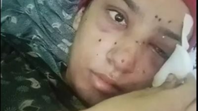 فقدت بصرها.. «بنت البلد» تحمي طفل من سلاح البلطجية بعينيها