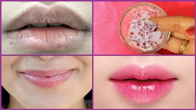 وصفات طبيعية لتفتيح الشفاه والتخلص من الاسمرار حول الفم