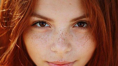 كريمات تساعدك على علاج النمش من وجهك