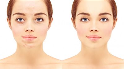 6 زيوت أساسية تُساعدك على الاعتناء بالبشرة المختلطة