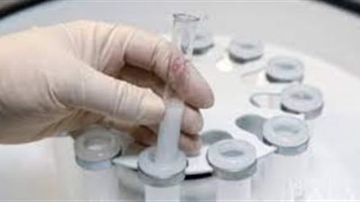 طبيبة أمراض نساء: 4 حالات تستدعي تجميد البويضات 