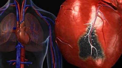 د. فرنسيس يكشف لـ