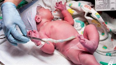 دار الإفتاء تكشف حكم تخزين الحبل السري للمولود 