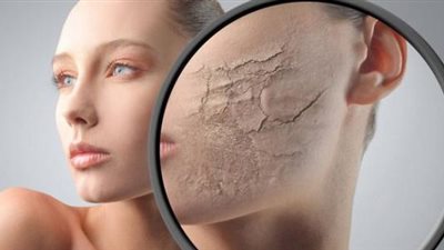 زيت الليمون والبابونج للتخلص من مشاكل البشرة الصعبة 