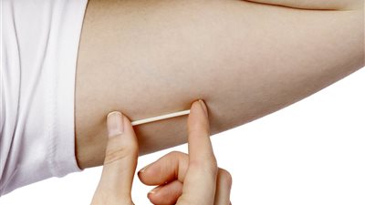 ماذا تعرفين عن شريحة منع الحمل وكيفية استخدامها؟