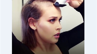 بعد حلق «شيرين» شعرها.. كيف تبني نفسك بعد الصدمة؟