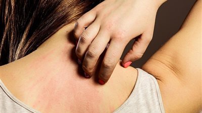 منها « الحد من الاستحمام».. طرق لتجنب حساسية الجلد عند تغير المواسم 