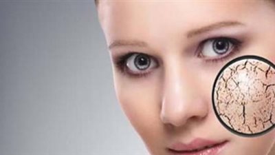 تعرفي على أفضل 5 خلطات طبيعية لتنعيم البشرة الجافة 