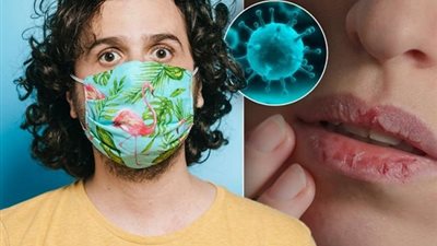 هل لديك شفاه رمادية؟.. انتبهي للإصابة بهذا المرض