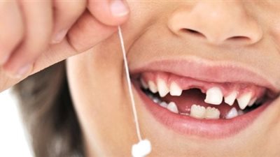 تفسير حلم سقوط الأسنان للعزباء والمتزوجة والحامل