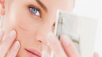 «احتفظي بجمالك».. عناصر طبيعية للتخلص من آثار الجروح والحروق