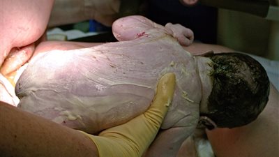 سر «الطلاء الشمعي» على الجنين والمسبب للرائحة المميزة