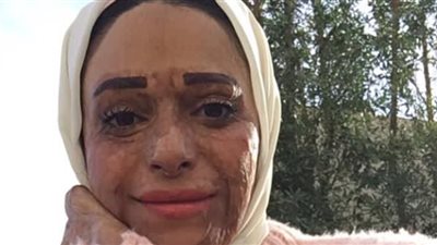 تعرفى على آخر الإجراءات القانونية ضد المتنمر على بطلة إعلان «أهل مصر».. والعقوبة المنتظرة