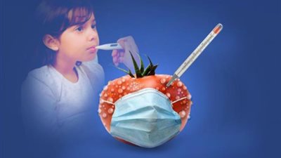 أنفلونزا الطماطم.. أخصائي يكشف أعراضها وطرق علاج الأطفال منها