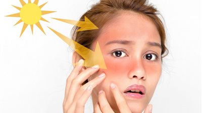 لو بتنزلي كل يوم.. نصائح تحمي بشرتك من أضرار الشمس