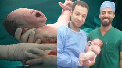 طبيب أسرع ولادة في العالم: «كانت فاكرة بروز بطنها من القولون» 