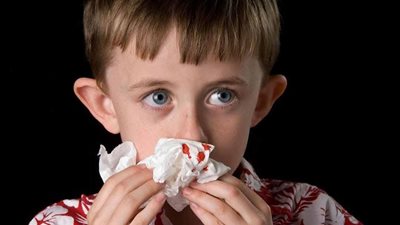 «ارتفاع الطقس ونزيف الأنف».. استشاري يوضح الأضرار وكيفية الوقاية| فيديو