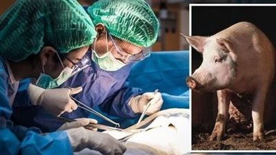 حكم زراعة كلية خنزير بجسد الإنسان.. مركز الأزهر للفتوى يُجيب