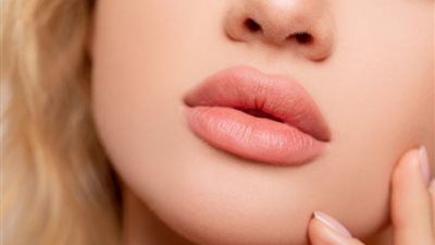 بسبب فيلر الشفايف.. تشوّه وجه فنانة مصرية في الكويت