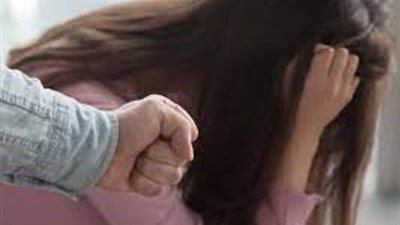 حقيقة سحجات وخدوش بالذقن والرقبة.. ننشر التقرير الطبي بعد سحلها 