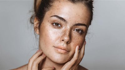 البوتكس حلال وهذا حكم إزالة النمش والحسنات.. رأي الدين بتجميل الوجه للنساء 