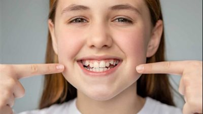 للفتيات.. هذا هو حكم عمليات تقويم الأسنان وتجميل الفكين!