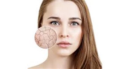علاج سحري لـ 5 مشكلات تواجه البشرة والشعر في الخريف