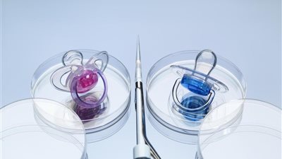 «يارب ولد» اعرفي حكم الدين في التدخل الطبي لتحديد نوع الجنين