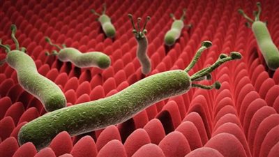 أستاذ جهاز هضمي: مخاطر جرثومة المعدة لا يمكن تجاهلها.. أبرزها السرطان