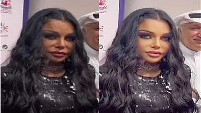 بعد ظهور مثير للجدل.. حقيقة تشوه وجه هيفاء وهبي بسبب عمليات التجميل