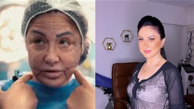 تطورات الحالة الصحية لـ وفاء سالم بعد خضوعها لعملية تجميل