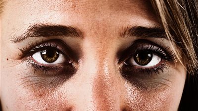 5 طرق بسيطة لتجنب الهالات السوداء حول العين