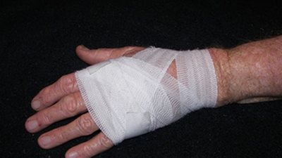  المتهم ببتر يد زوج أخته: «أردت تأديبه لكثرة تعديه على شقيقتي بالضرب»