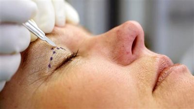 أهمها الشاي الأخضر.. 6 خطوات لمحاربة تدلي الجفون