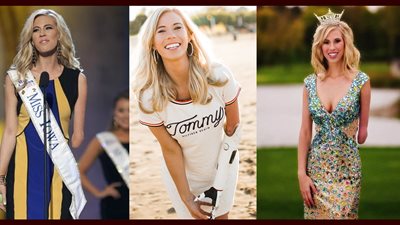 نساء ملهمات.. «نيكول كيلي» ولدت بنصف ذراع وصارت ملكة جمال 