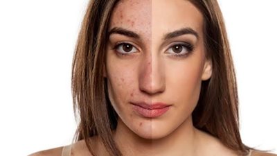 بينها الحساسية.. إليكِ أضرار المكياج اليومي على البشرة