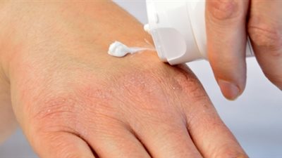 والدة الطفلة حنين: المدرس حرق بنتي بسبب «شرب الشاي»