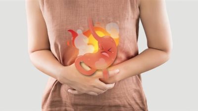 كيف تعالجين حموضة المعدة بطريقة سهلة في المنزل؟