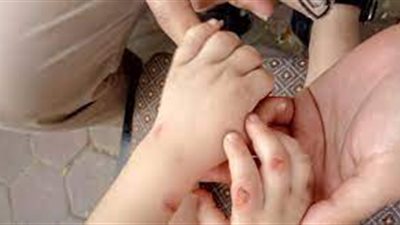 « اغتال البراءة» أب يعذب طفلته الرضيعة حتى الموت 