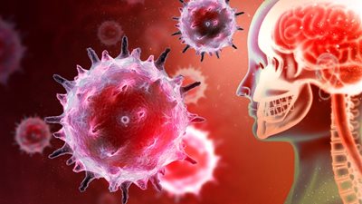 دراسة تحذر من عدوى فيروسية تنشط بعد سنوات وتسبب السكتة الدماغية