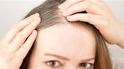 « تخلصي من الشعر الأبيض» روتين العناية بشعرك خلال 5 دقائق فقط