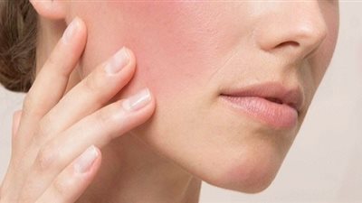 زيوت تعالج التهابات وتهيّج البشرة «الزعتر والنعناع»