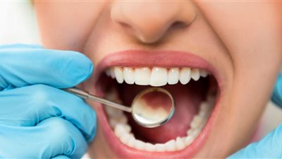 كيف تحمين أطفالك من الإصابة بتسوس الاسنان؟ 