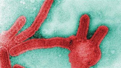 «بعد وفاة 9 أشخاص» الصحة العالمية تحذر من فيروس ماربورج