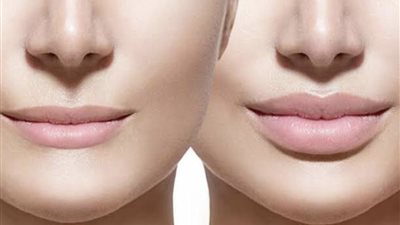 10 وصفات طبيعية للحصول على شفاه ممتلئة مفعمة بالأنوثة