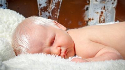 ولادة طفل بشعر أبيض في المجر وسط دهشة الأطباء ويلقب «الرضيع المبهج»