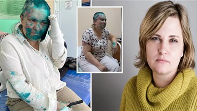 صحفية روسية تتعرض لهجوم شرس في الشيشان| حلقوا رأسها وكسروا أصابعها وصبغوا وجهها بالأخضر