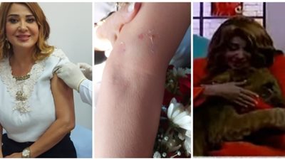 مادلين طبر تتعرض لعضة أسد في برنامجها (فيديو)