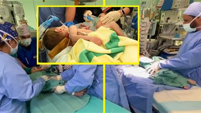 نجاح فصل التوأم السيامي السوري| والربيعة: لا نتوقع النجاة للطفل إحسان لأنه المتطفل